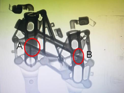 X-Ray of Trial Defects