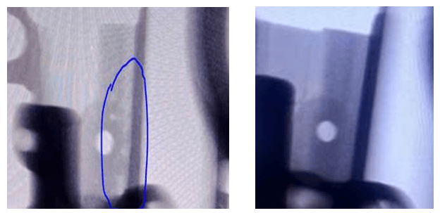Defect Comparison Before and After