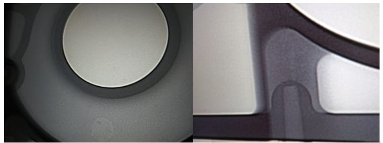 X-ray of optimized die casting part